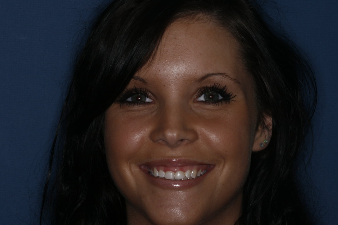 Woman smiling brightly against blue background, showcasing healthy white teeth.