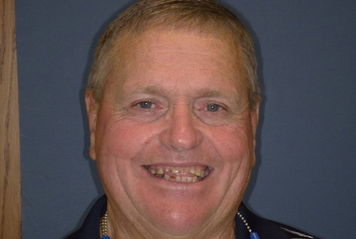 Middle-aged man smiling at camera against blue background, professional headshot for dental practice.