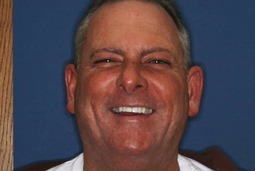 Smiling man in white shirt against blue background, professional headshot for dental practice.