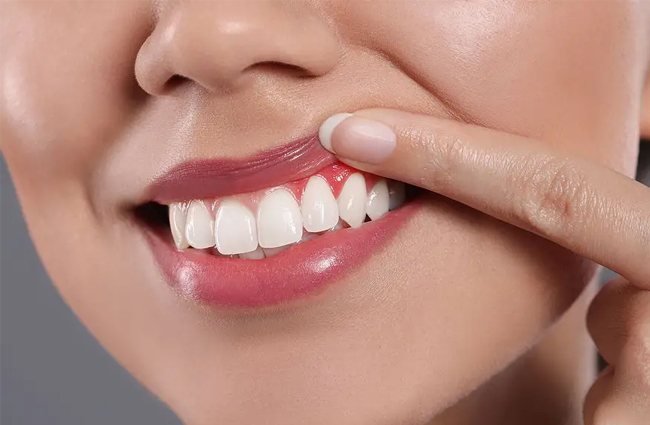 Person displaying bright white teeth and healthy gums with finger pointing to gum area.